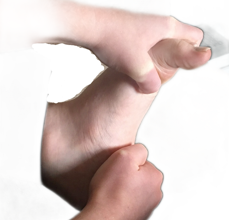 Toe Deformities - Keeping Me Well