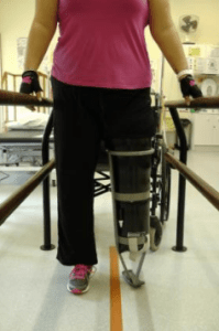 Person with metal PPAM equipment on leg amputated below knee