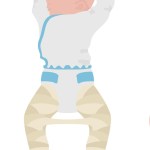 Baby in full length hip spica cast |Cast Sbica Clun