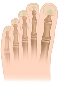 Skeleton of the foot showing toe joints