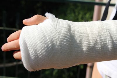 Upper limb fracture / Torasgwrn yn rhan uchaf y corff